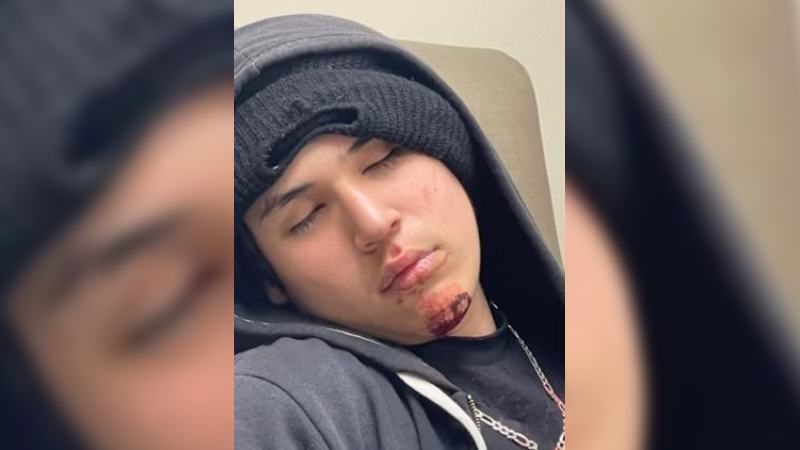 Policía de Minneapolis pide ayuda para localizar a joven desaparecido López Giovanni