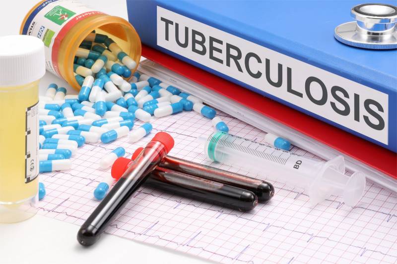 Tuberculosis en personas con parole humanitario