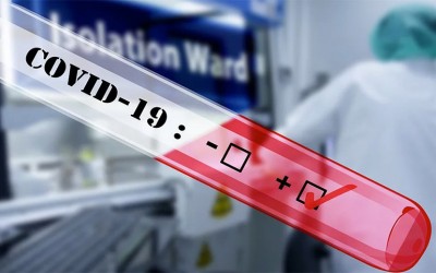 casos confirmados de COVID-19 en 31 condados de Minnesota
